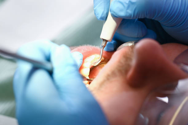Best Emergency Cosmetic Dentistry (e.g., broken veneers) in Lookout Mountain, TN