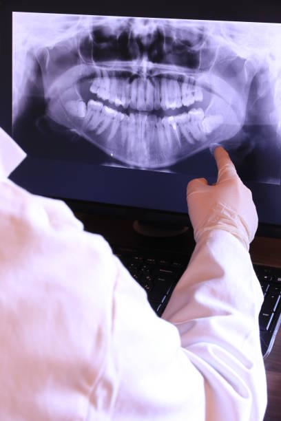 Best Emergency Dental Care for Sports Injuries in Lookout Mountain, TN